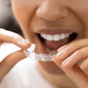 Custom night guards for teeth grinding protection