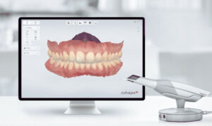 3Shape TRIOS Intraoral Scanner Digital Workflow for Dental Lab