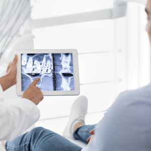 Future of Digital Dentistry 2025 Intraoral Scanning and CAD CAM Workflow