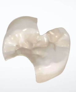 Digital Inlay / Onlay / Overlay Design Service