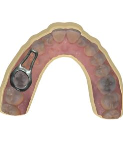 Digital Space Maintainer Design Band and Loop for SLM Printing