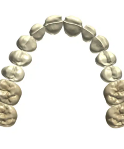 Digital Coping & Framework Design Service (PFM / PFZ)