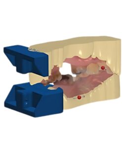 Digital Crown and Bridge Model Design with Removable Dies