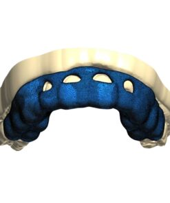 Digital Crown Lengthening Guide Design for Gummy Smile Correction