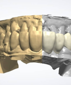 Digital Dental Crown Design Zirconia Full Contour on Exocad