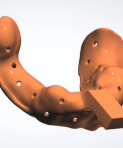 Digital Custom Impression Tray Design with Tissue Stops and Handle