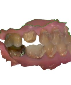 DICOM CBCT Scan Converted to STL 3D Model Skull