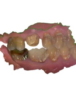 Professional DCM to STL Conversion. We convert dental CBCT (DICOM) scans into clean, printable STL models. Artifact removal included. 24h Delivery.