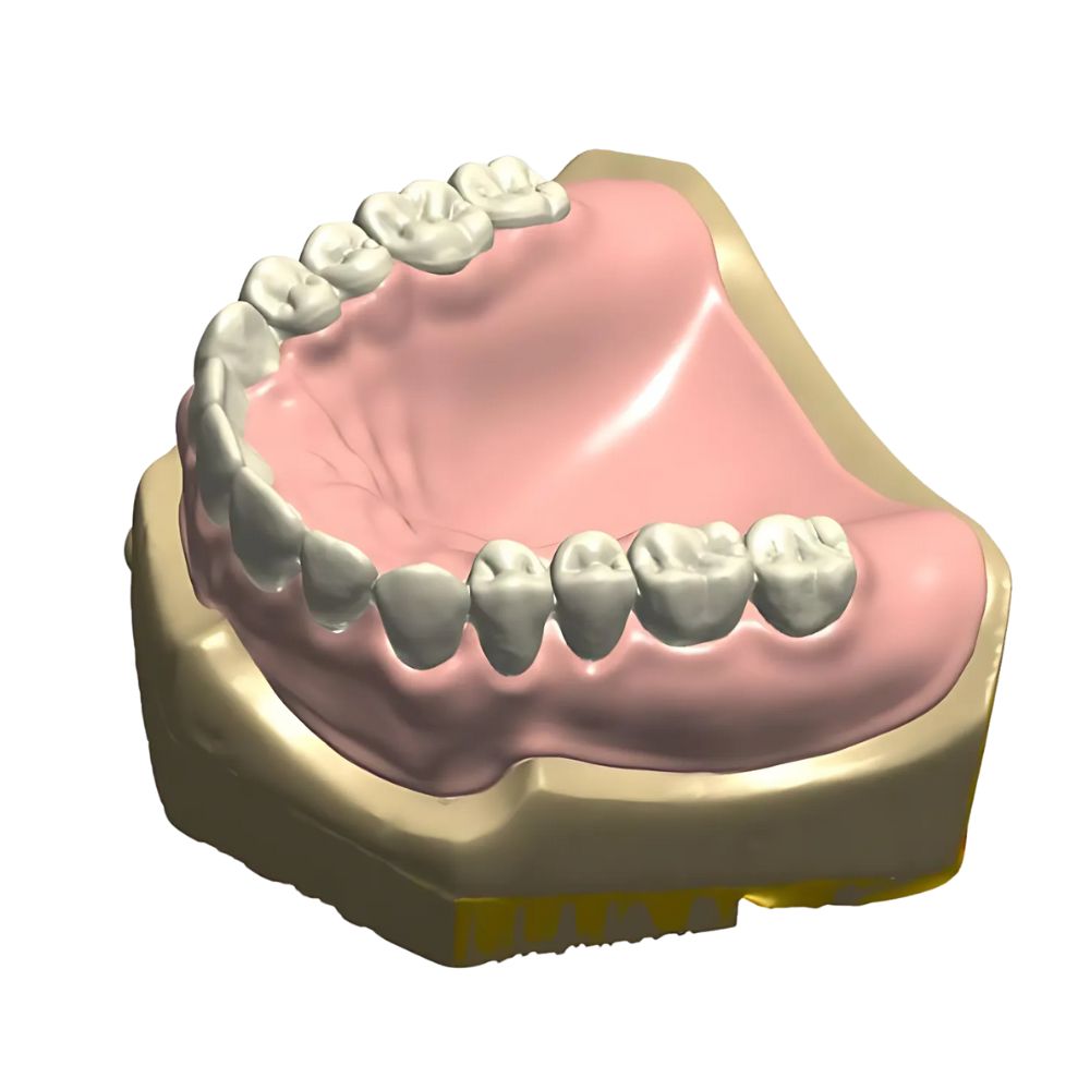 Digital Full Denture Design 3D Printed Base and Teeth