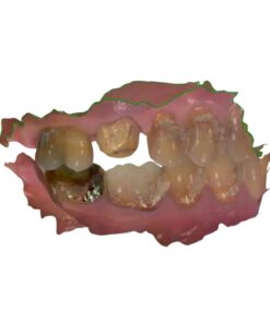 STL to 3Shape DCM Conversion for Model Builder Workflow