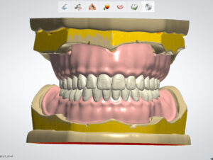 Digital full denture design services using CAD/CAM