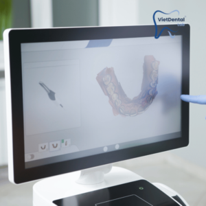 Digital dental bridge design using CAD software