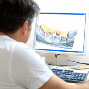 Dental CAD Design Technician working with 3Shape software
