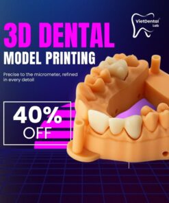 3D Printed Dental Implant Model with Soft Tissue Gingiva Mask